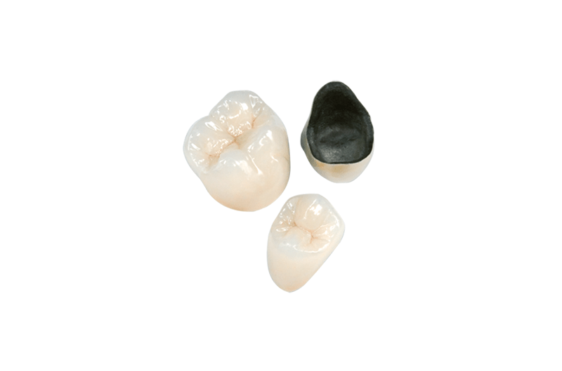 Corona dental de metal (níquel-cromo) –