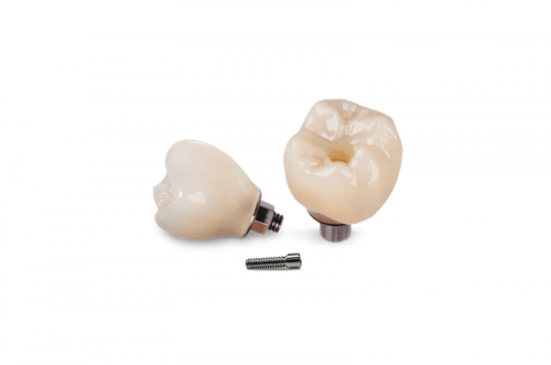 Las mejores coronas ZR de porcelana atornillada sobre implante