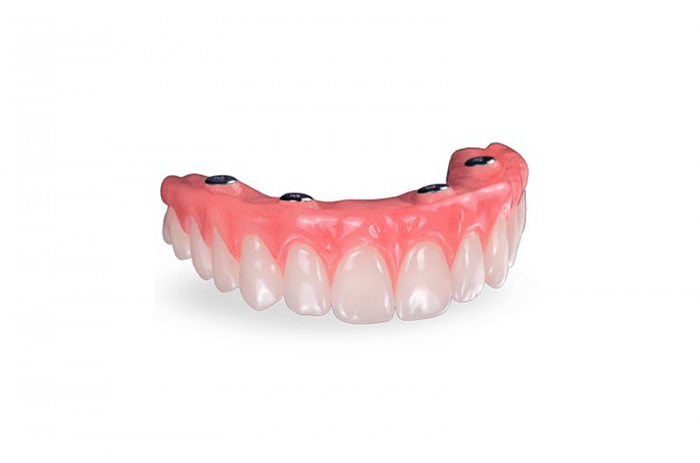Las mejores dentaduras híbridas CAD/CAM de metal acrilico